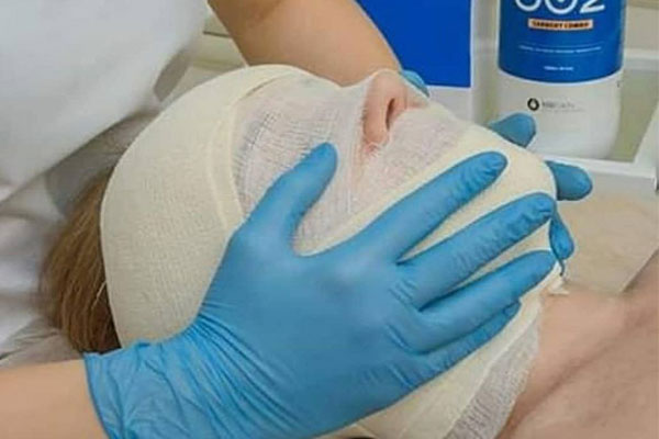 آموزش کربوکسی تراپی در کرج آموزش کربوکسی تراپی در کرج